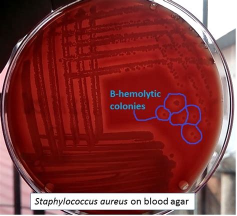 s aureus beta hemolytic|Staphylococcus Aureus: From Morpholo.